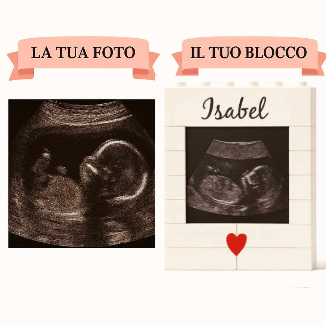 Set personalizzato di mattoncini